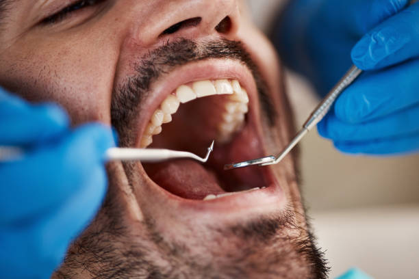 Best Emergency Root Canal Treatment in Springfield, OR